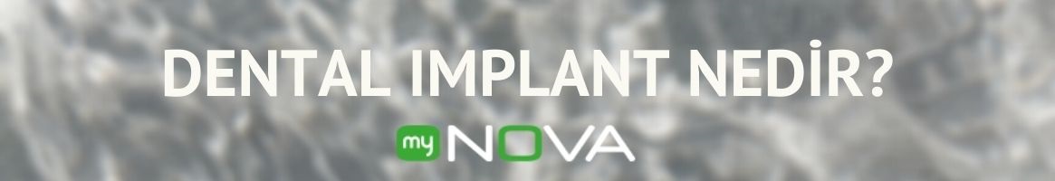 https://mynovaklinik.com/implant-tedavisi/