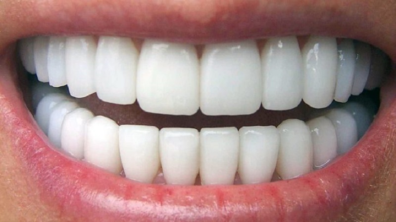 Dental İmplantlara Uygun olup olmadığınızı Nasıl Anlarsınız?