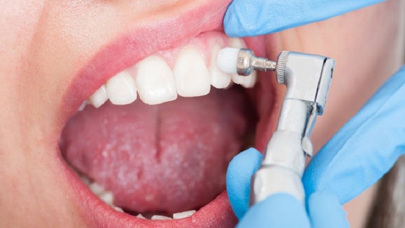 Dental İmplantlara Uygun olup olmadığınızı Nasıl Anlarsınız?